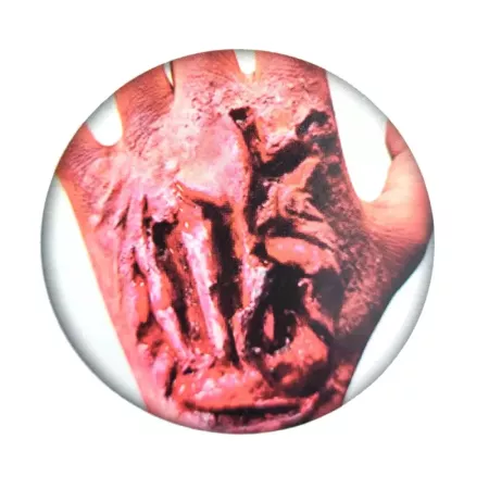 Tradineur - Cicatriz postiza para la mano - Diseño realista - Ideal como complemento para disfraces, carnaval, Halloween - 7,5 x