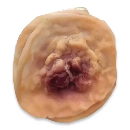 Tradineur - Blíster de herida con pústula - Diseño realista con relieve - 2 Unidades - Ideal como complemento para disfraces, ca