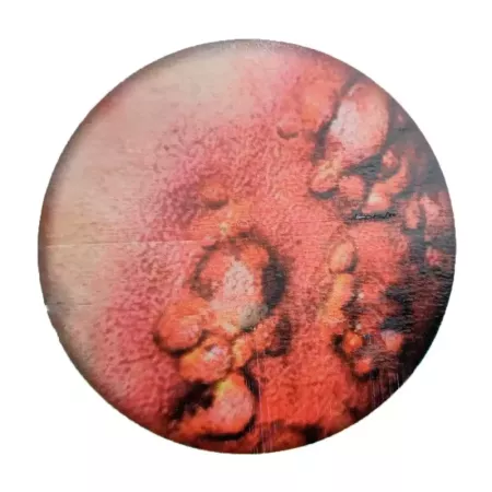 Tradineur - Blíster de herida con pústula - Diseño realista con relieve - 2 Unidades - Ideal como complemento para disfraces, ca
